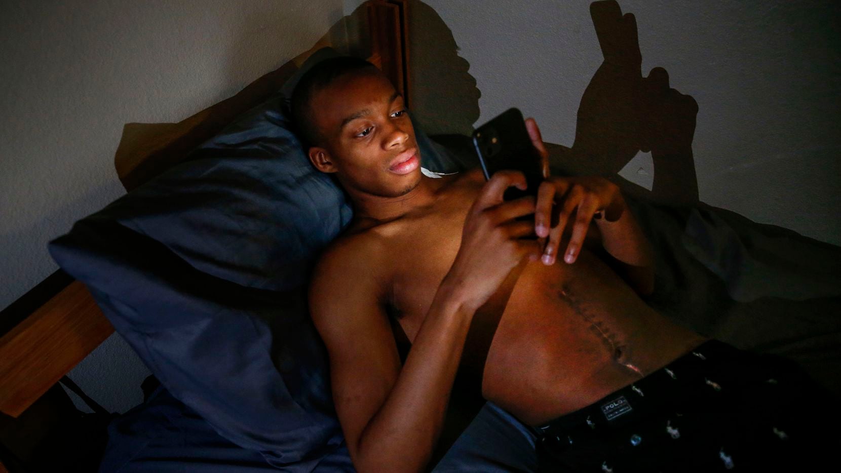 Exposing a scar left behind on his stomach from surgery to remove a lodged bullet, Jaylon...