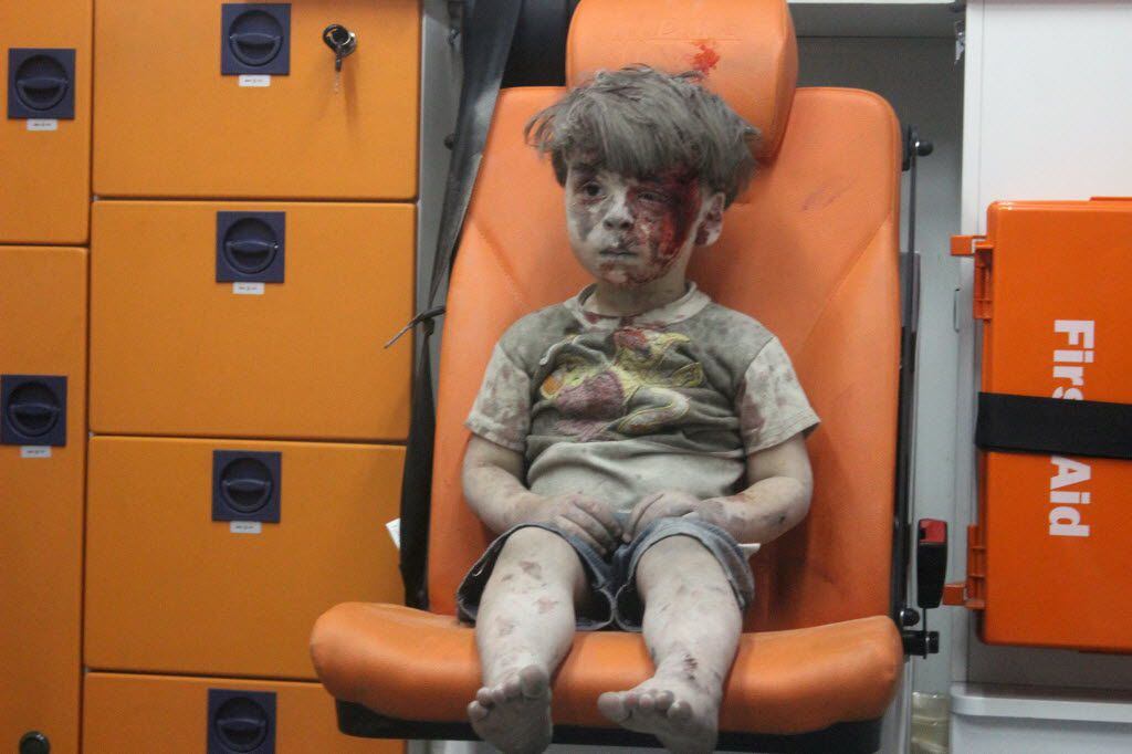 Omran Daqneesh, a 5-year-old Syrian boy covered in dust and blood, sits in an ambulance...
