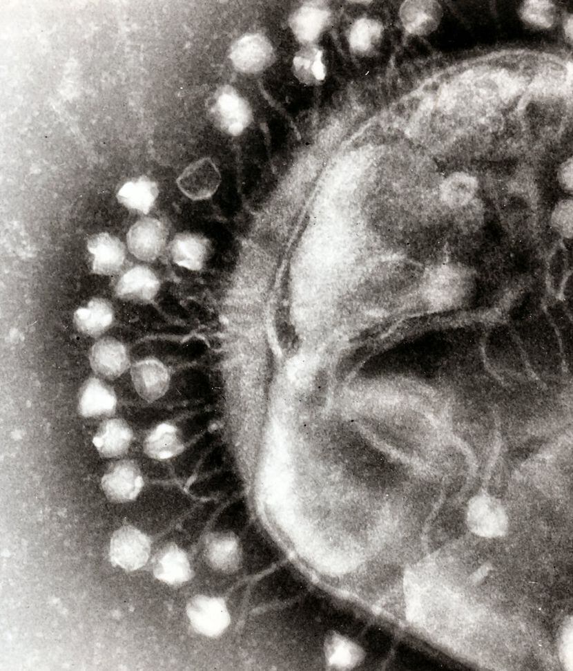 An electron micrograph of multiple bacteriophages attached to a bacterial cell wall, at a...