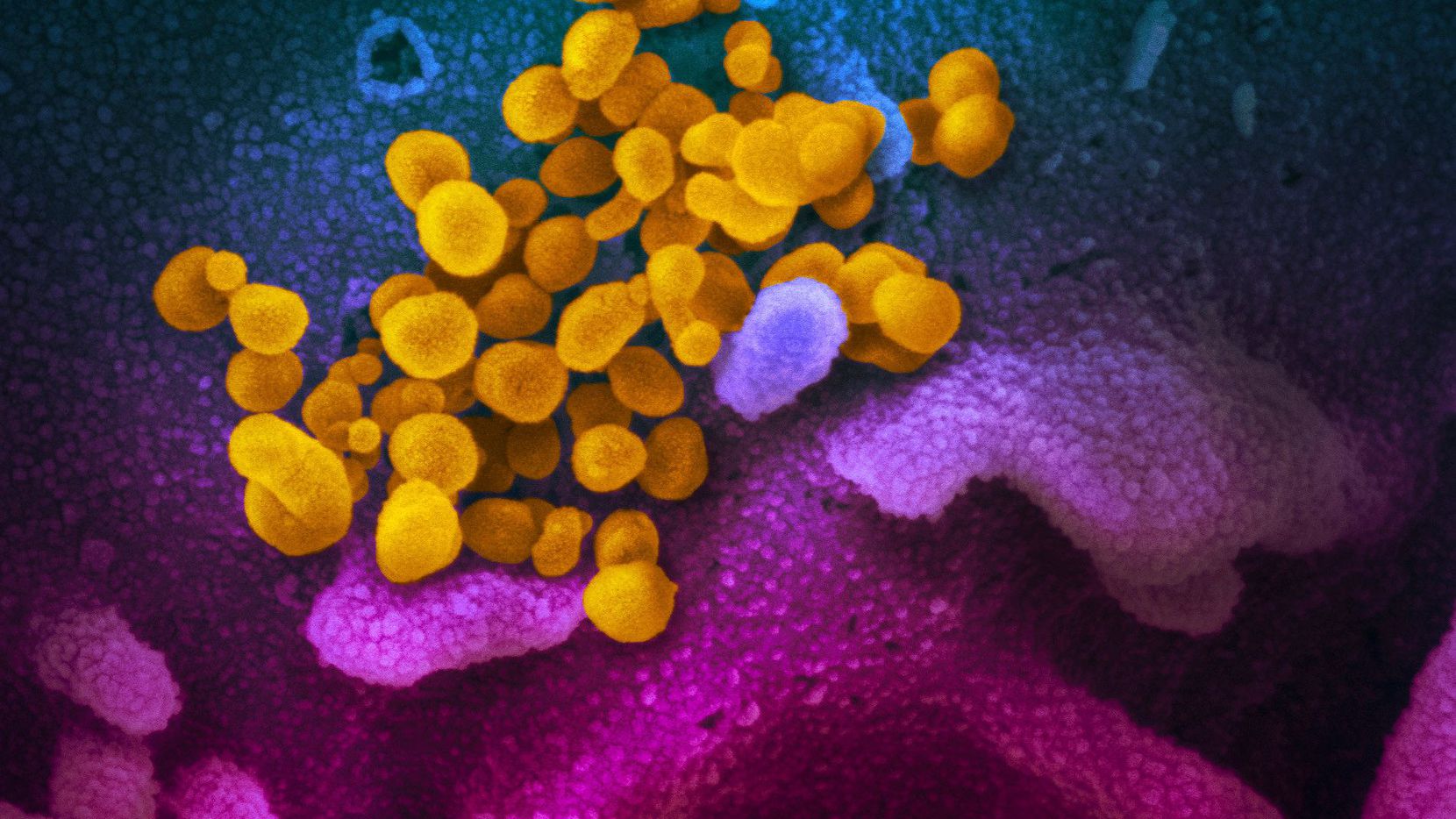 This image courtesy of the National Institutes of Health shows SARS-CoV-2, also known as 2019-nCoV, the virus that causes COVID-19.