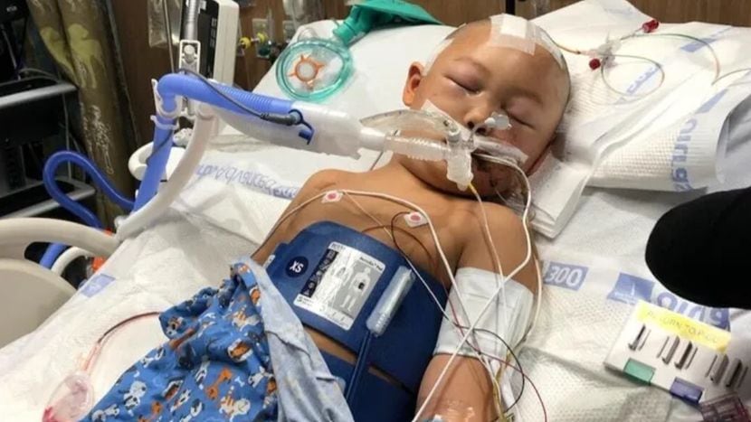 Support pours in as Texas 6-year-old struck in head with baseball bat fights for survival