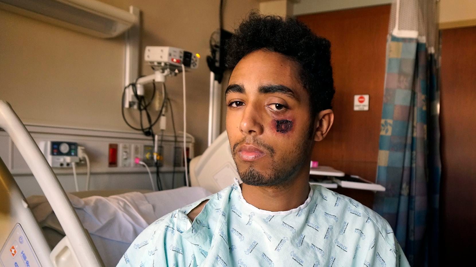 Vincent Doyle said he was struck by a so-called less lethal bullet during a May 30 protest in downtown Dallas. The 21-year-old Frisco resident recovered at an area hospital. (Lawrence Jenkins/Special Contributor)