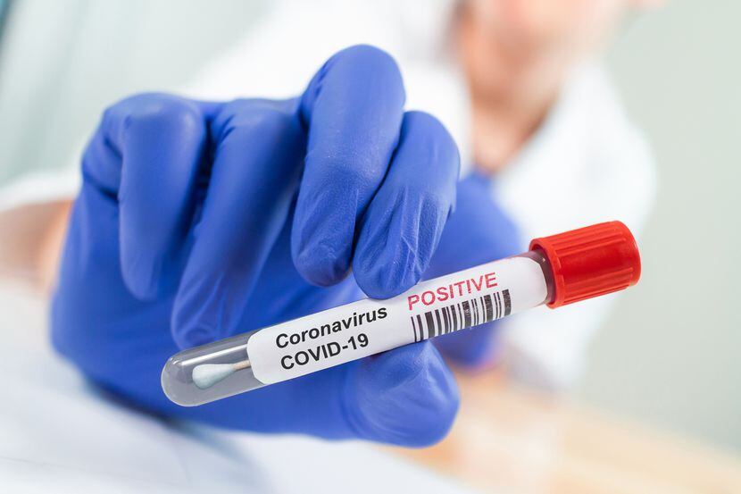 Una muestra de covid-19 tomada de una persona infectada de coronavirus.