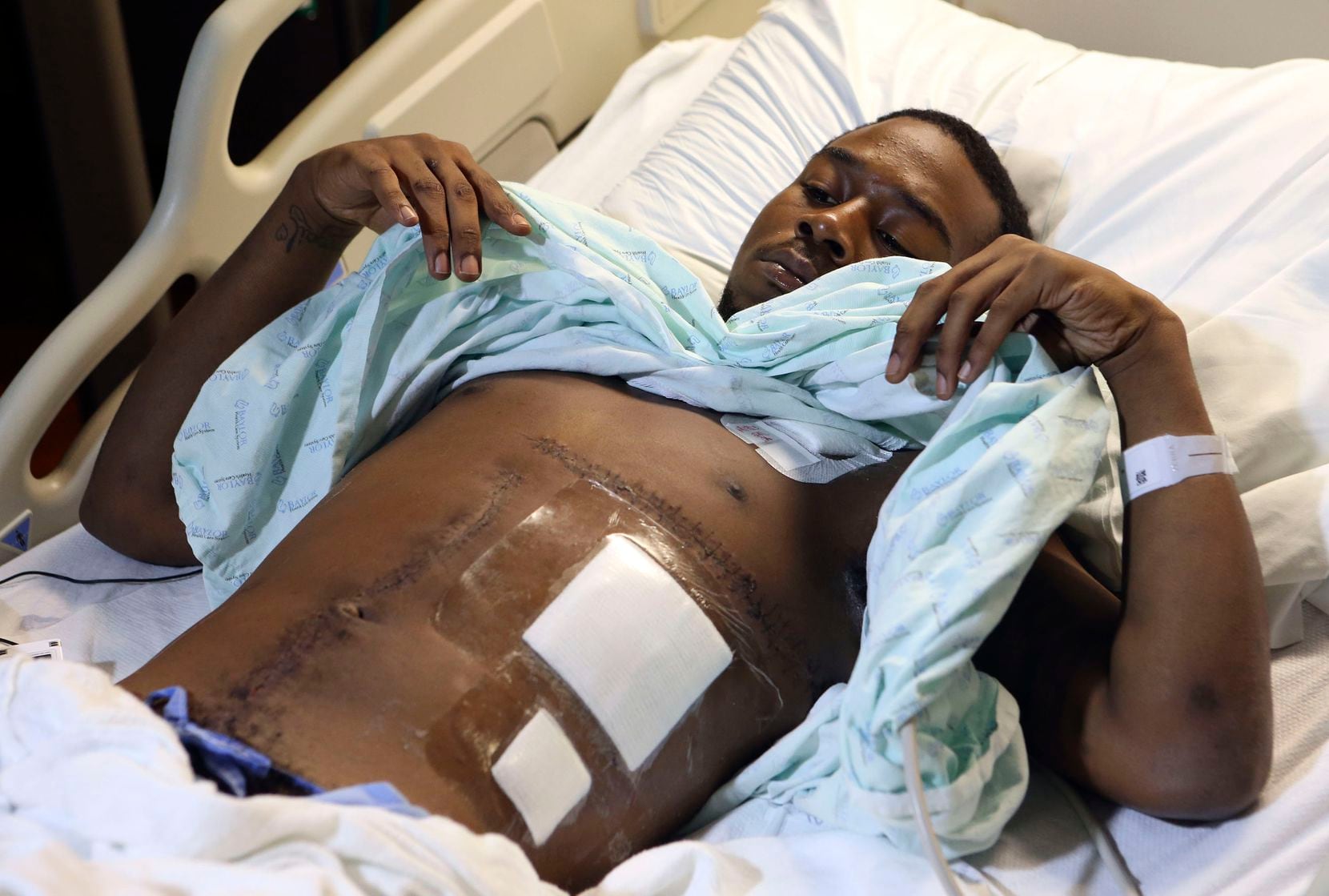 Kelvion Walker, 19,  shows his wounds from the surgery that saved his life after he was shot by Senior Cpl. Amy Wilburn in December 2013. An independent witness said the officer shot Walker even though he had both hands in the air and showed no signs of having a weapon. 