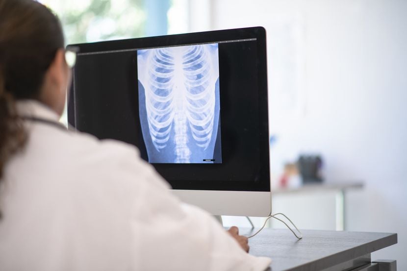 Una doctora observa las placas de rayos X del pulmón de un paciente.