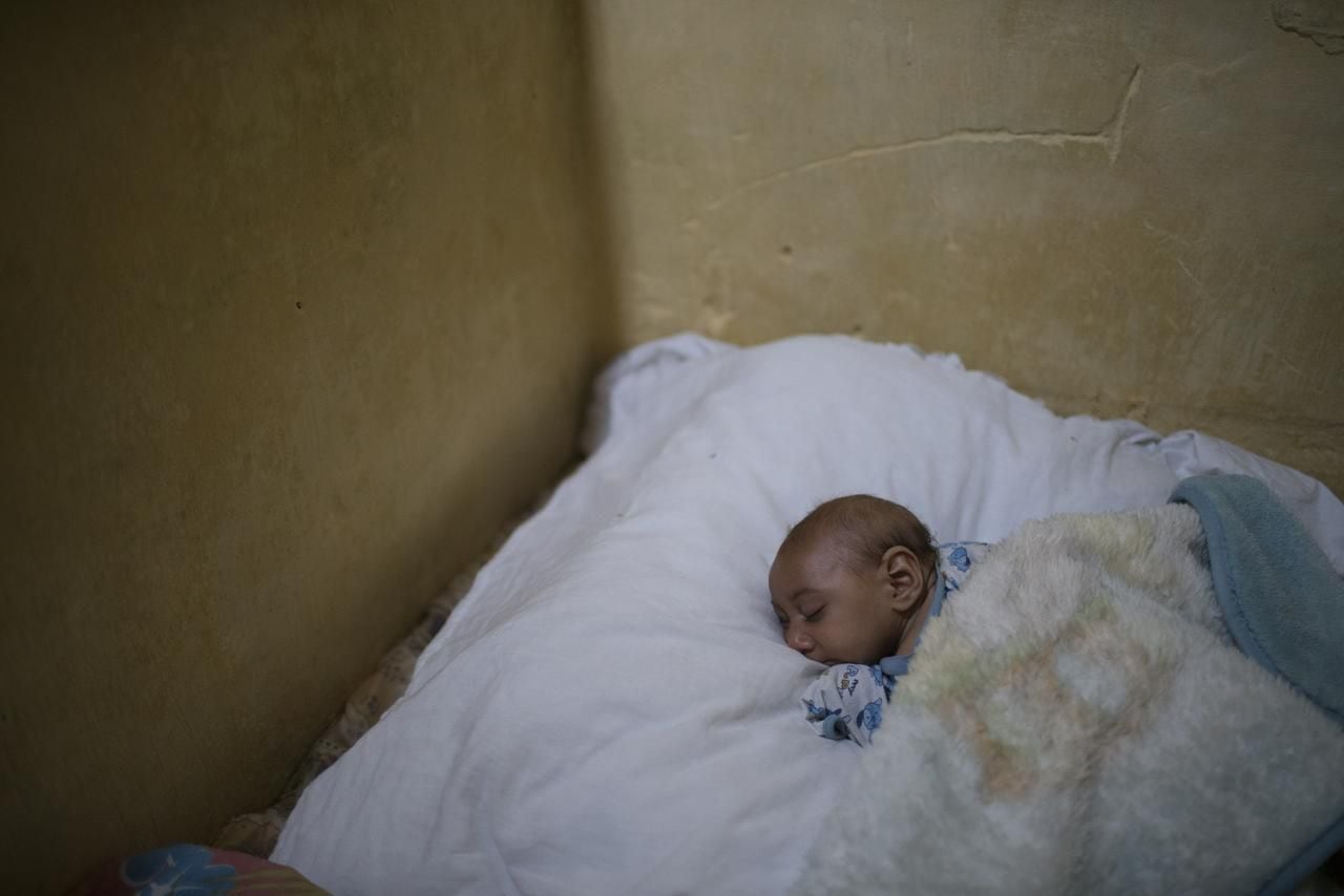 
A child who suffers from microcephaly sleeps on a large pillow on his mother’s bed in Brazil.
