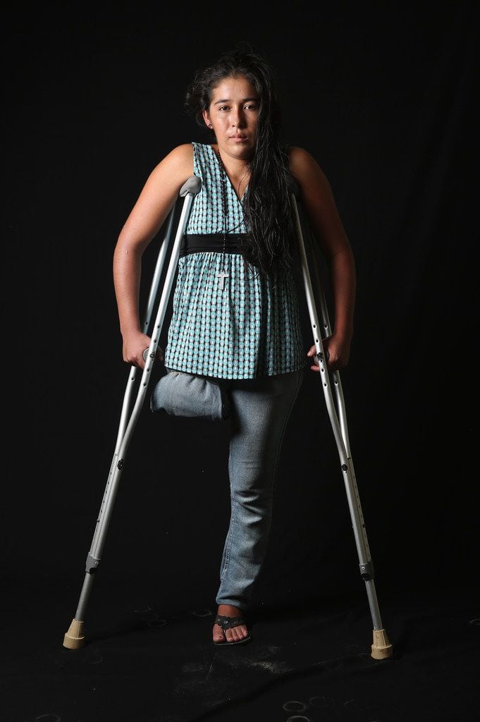  Undocumented Guatemalan immigrant Elvira Lopez, 22, stands on crutches at the Jesus el Buen...