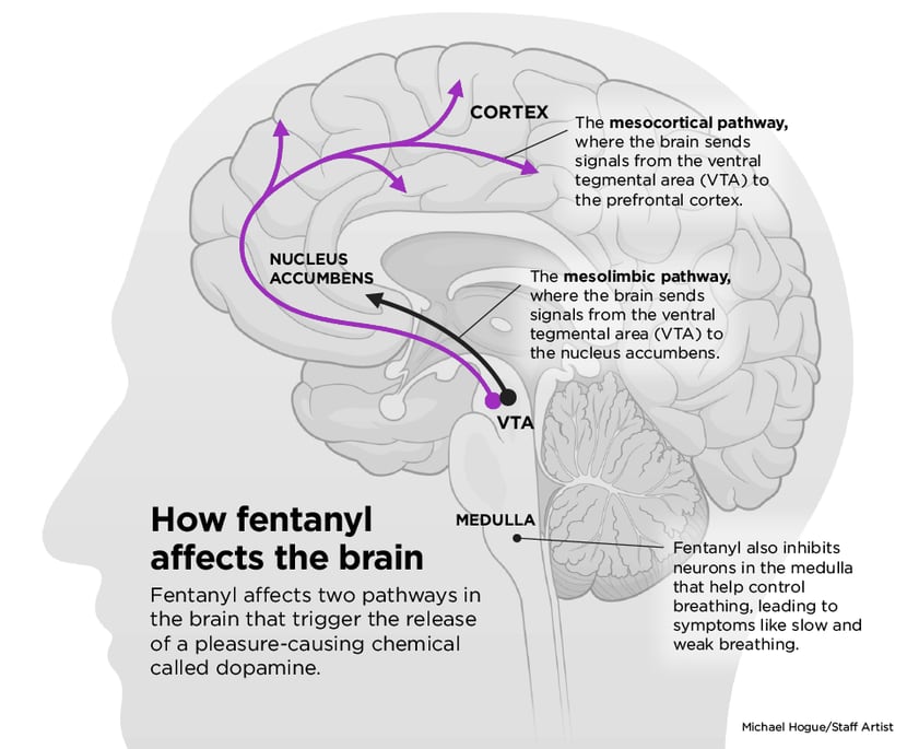 Q&A: What you need to know about fentanyl