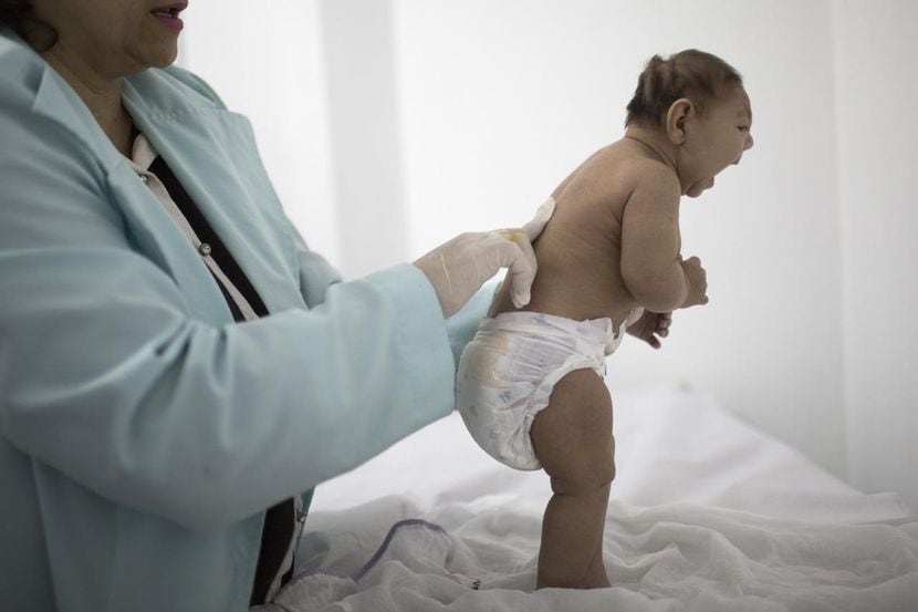 Lara, una niña de 3 meses que nació con microcefalia. Los Centros para el Control de...