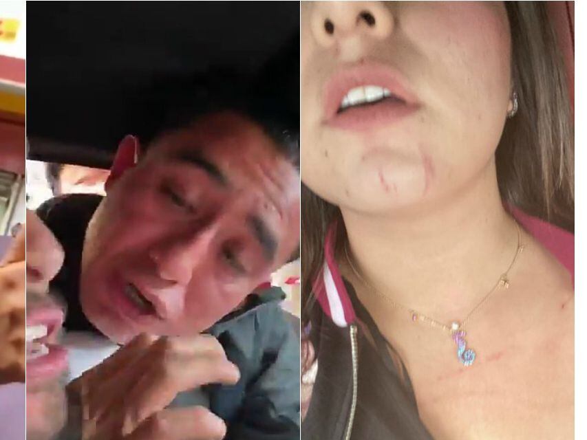 La esposa del portero de Pumas fue agredida por agentes de la policía de Ciudad de México.