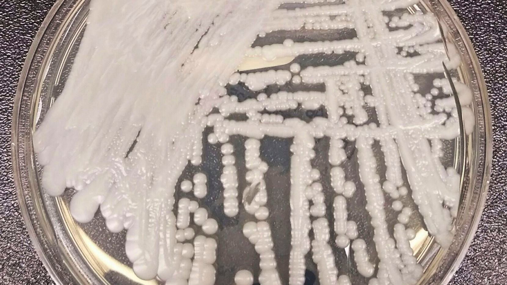 This 2016 photo shows a strain of Candida auris cultured in a petri dish at a CDC laboratory.
