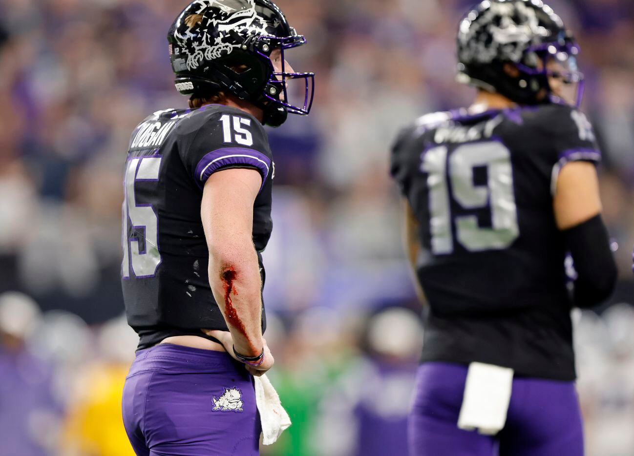 TCU Horned Frogs quarterback Max Duggan (15) was slow to get up partially due to his...