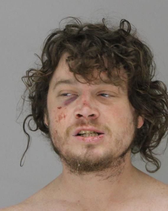 Kyle Vess' mugshot on August 3, 2019, after Dallas Fire-Rescue Paramedic Brad Cox repeatedly kicked him while he was lying on the ground.