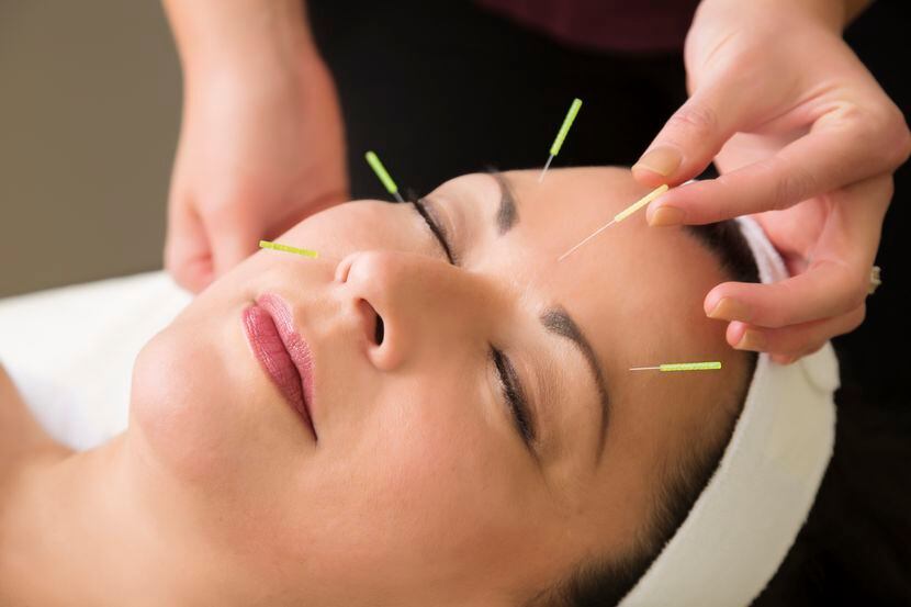 Después de probar acupuntura, las mujeres tienen alivio en sus oleadas de calor./iStock
