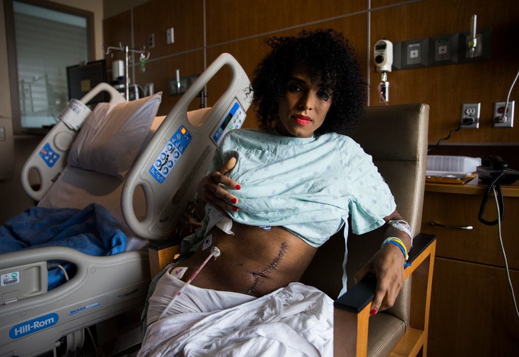 Daniela Calderon holds up her hospital gown to show scars on her abdomen from surgery in her...