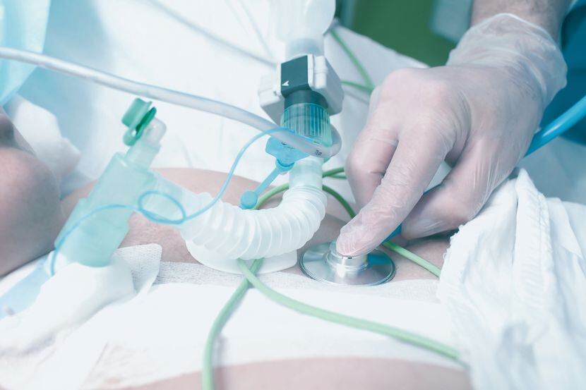 La traqueotostomía permite a un paciente poder respirar cuando se ha dificultado hacerlo por...