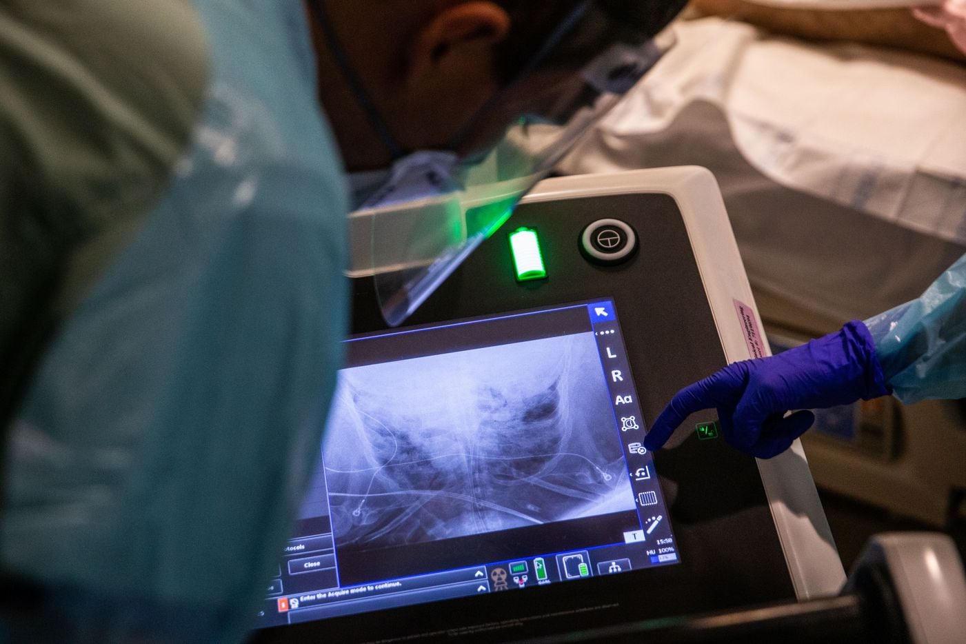 Parkland medical staff review an X-ray of a COVID-19 patient’s chest to make certain his intubation tubes are in correct placement.