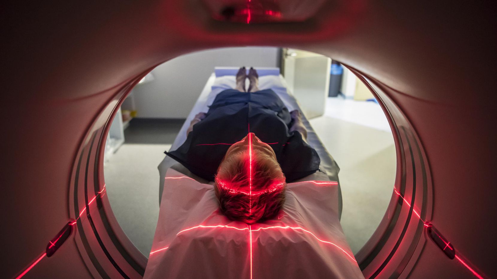 Una tomografía sirve para identificar un posible infarto cerebral. (GETTY IMAGES/iSTOCK)
