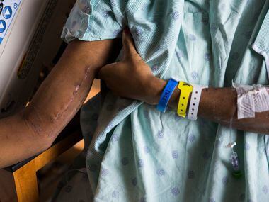 Daniela Calderon shows scars on her right arm from surgery in her north Texas hospital room...
