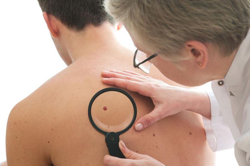 Un dermatólogo examina la piel de un paciente. (Getty Images/iStockphoto/AlexRaths)
