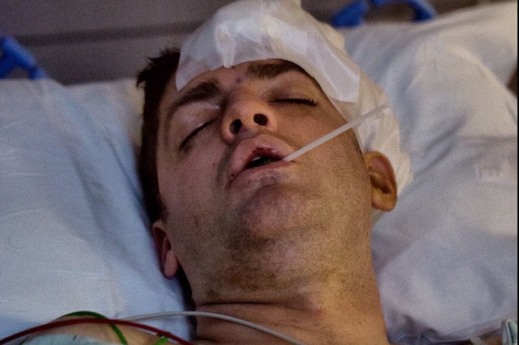 Derek Whitener's skull was fractured when two masked men attacked him. (GoFundMe)