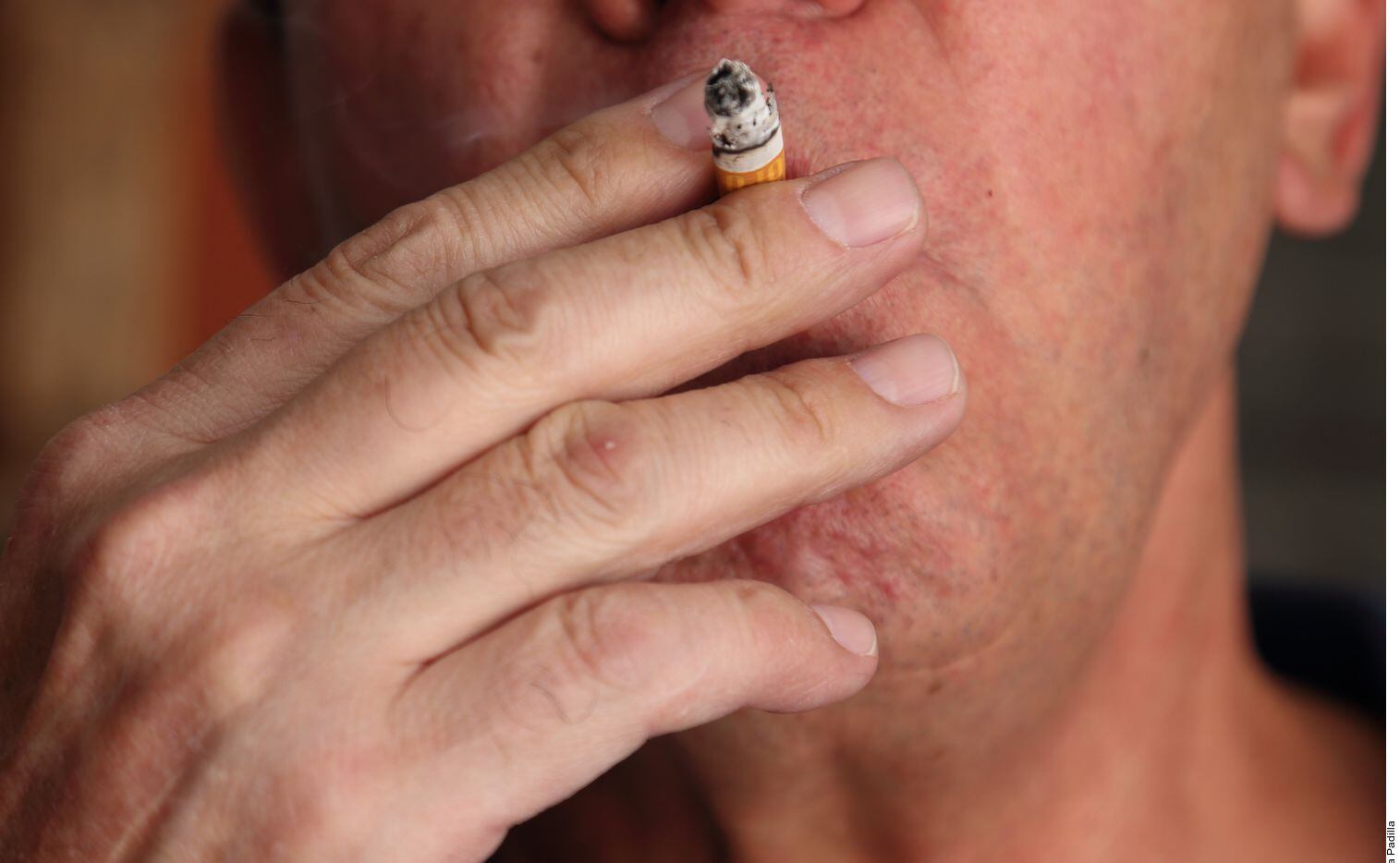 En caso de contagiarse de covid-19, un fumador tiene 2.4 veces más probabilidad de ser...