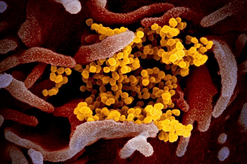 This image shows the novel coronavirus SARS-CoV-2, yellow, emerging from the surface of...