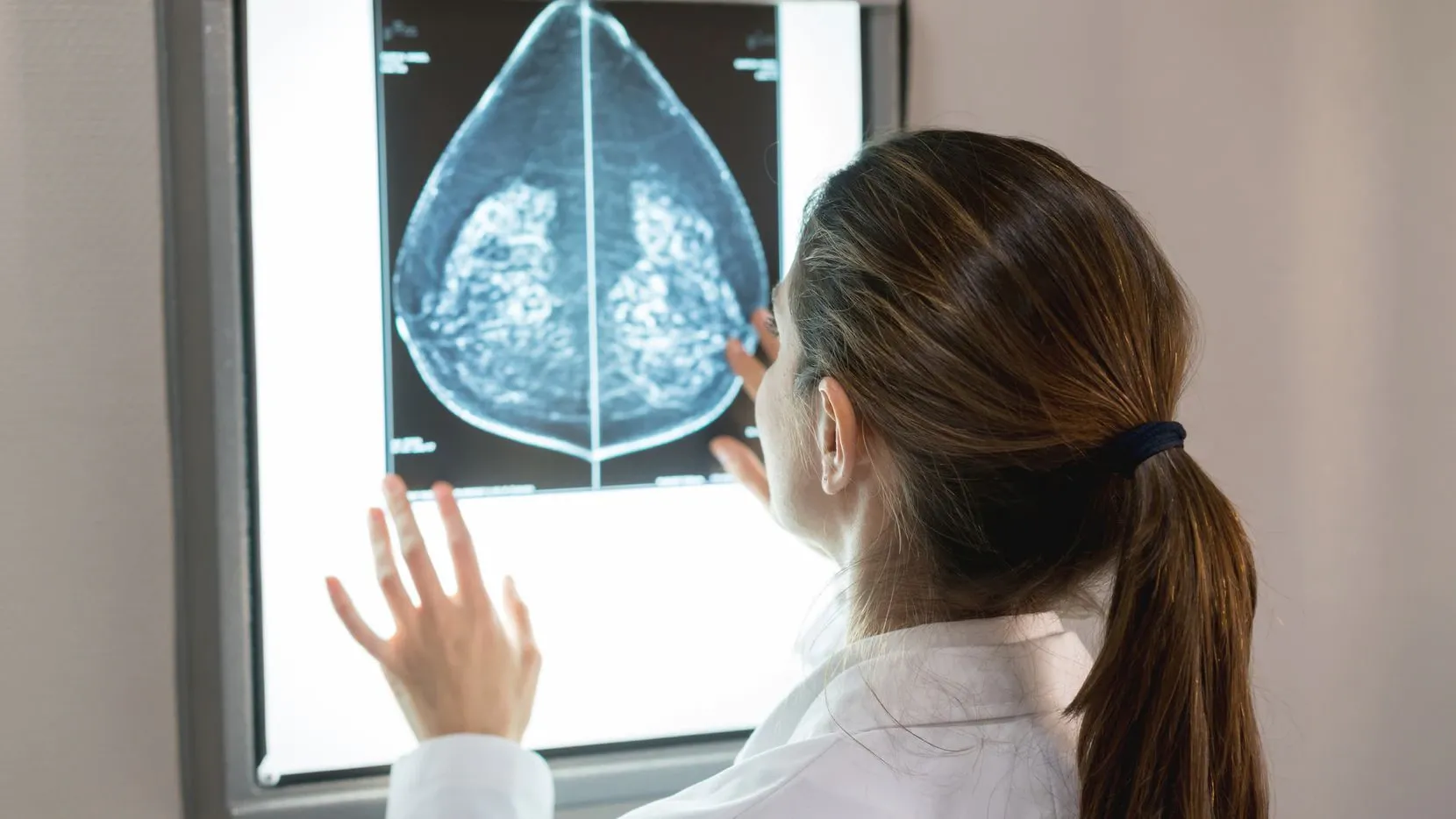Fotografía de una mujer viendo el rayo x de una mamografía.