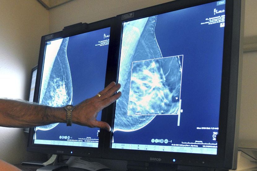 En julio se proveerá de mamografías gratuitas en Oak Cliff. iSTOCK
