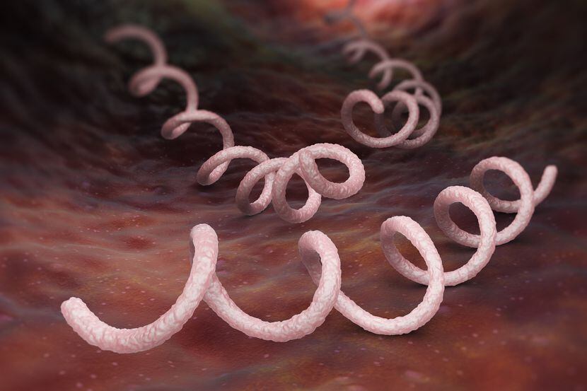 Syphilis is a sexually transmitted infection caused by the spirochete bacterium. The...