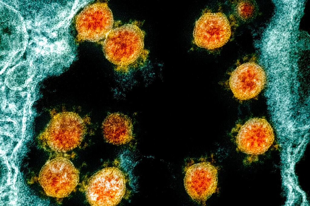 mágenes de partículas del nuevo coronavirus SARS-CoV-2. Fotos tomadas con microscopio de...