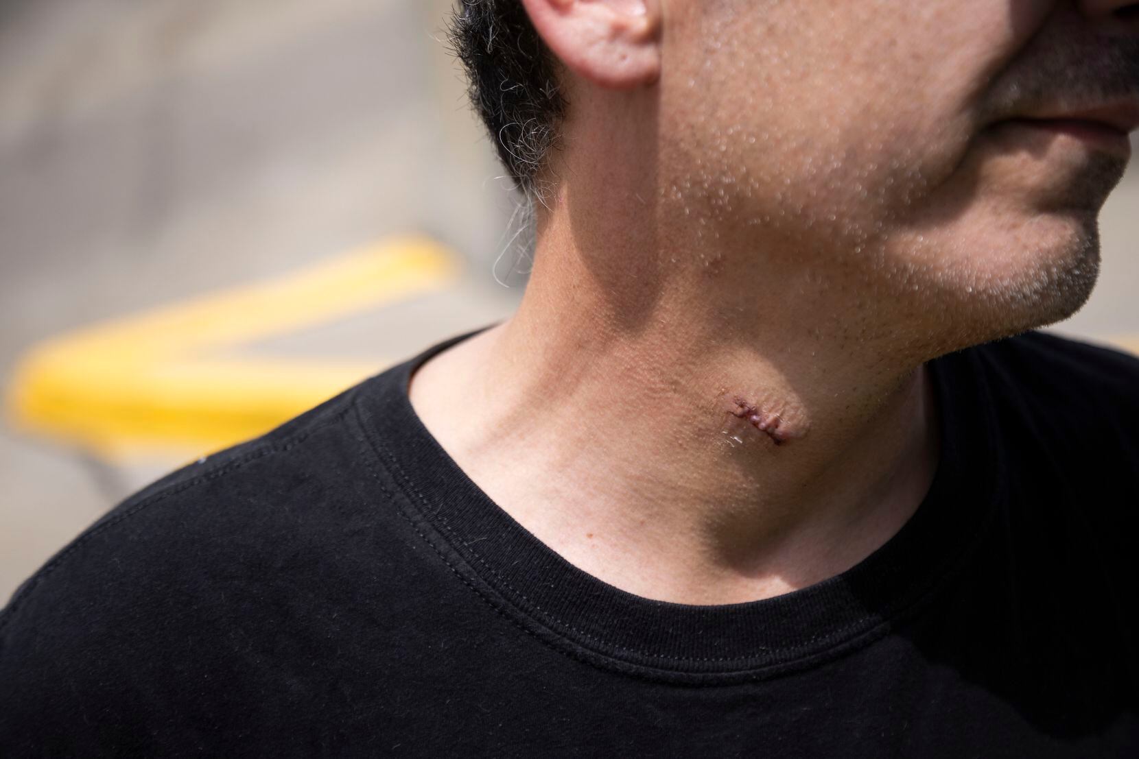 Uber driver Joshua Escandon was stabbed in the neck while on the job Tuesday night  in the...