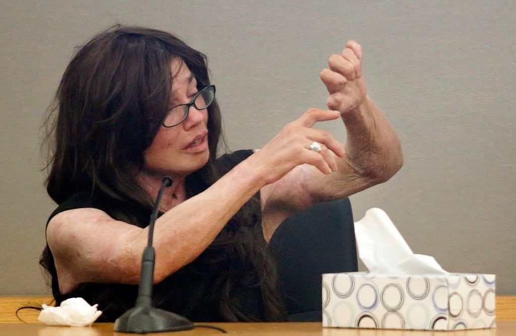 Burn victim Danyeil Townzen removed her jacket and showed her scars and her limited movement to the judge and her former boyfriend Matthew Gerth during her emotional testimony, Friday, September 13, 2019. Gerth earlier plead guilty to aggravated assault with a deadly weapon and serious bodily injury for the 2018 crime in the 283rd District Court at the Frank Crowley courthouse in downtown Dallas. 