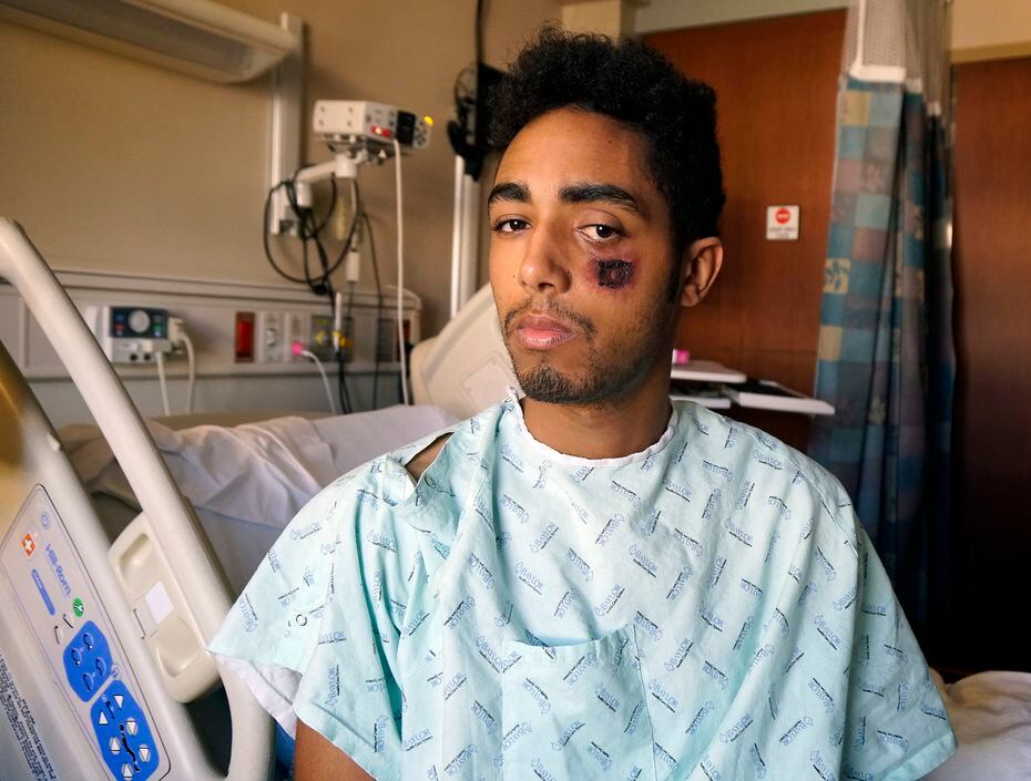 Vincent Doyle said he was struck by a so-called less-lethal bullet during a protest in...