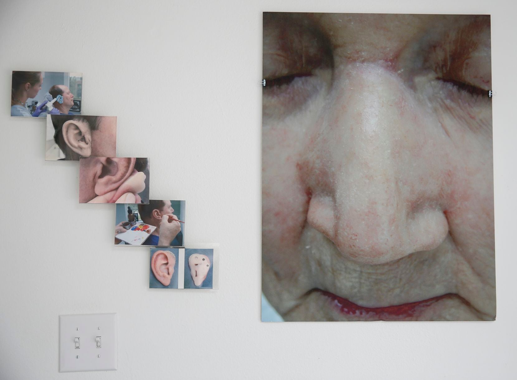 Archived photos of Mosaic Prosthetics patients hang on the wall of his offices in McKinney. 