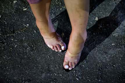 On an unseasonably hot night, Brooklynn’s feet are swollen in her high heels as she spoke of...