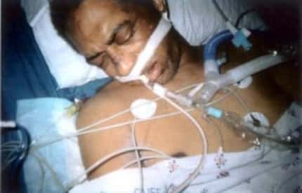  James Mims, then 53, shown in Parkland Memorial Hospital after being transferred from Lew...