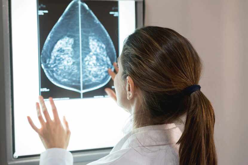 Fotografía de una mujer viendo el rayo x de una mamografía.