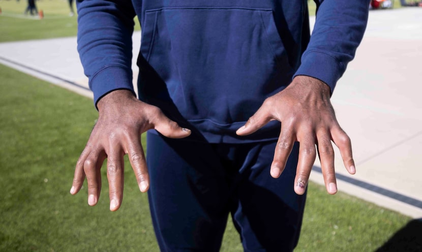 Cowboys left tackle Tyron Smith dislocated his right ring finger during a game-winning drive...