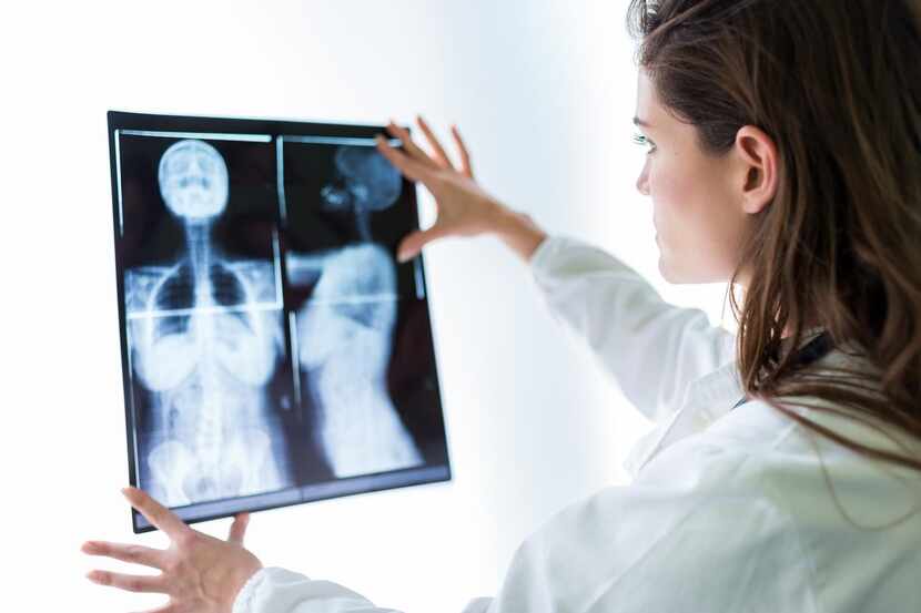 Una doctora analiza placas de rayos X de una paciente.(GETTY IMAGES)
