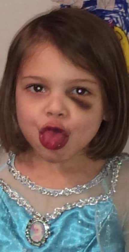 Leiliana Wright had a black eye in a photo taken two months before her death.