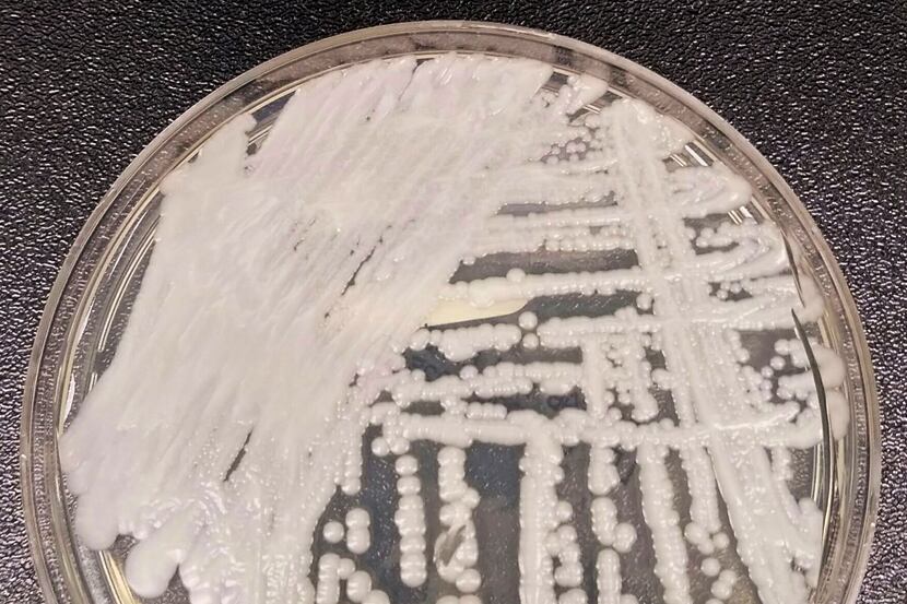 This 2016 photo shows a strain of Candida auris cultured in a petri dish at a CDC laboratory.
