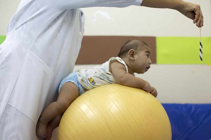 Beijamin Santos, quien nació con microcefalia, recibie terapia física en Joao Pessoa,...