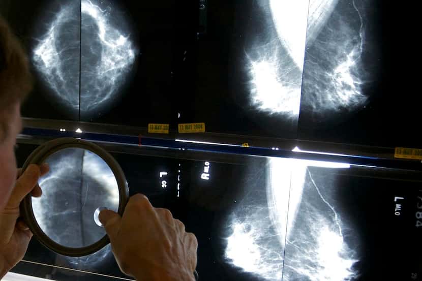 Un radiólogo checa los resultados de mamografías en Los Ángeles. (AP/DAMIAN DOVARGANES)
