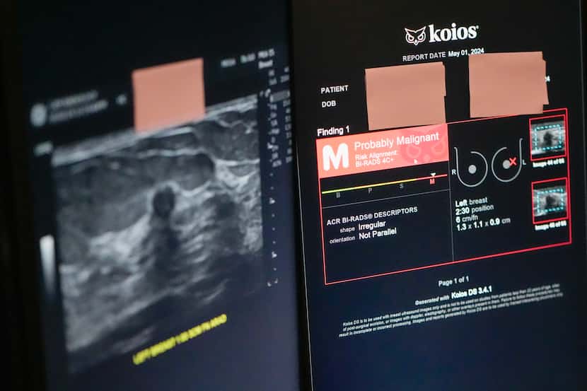 The Koios DS Smart Ultrasound software, used to get a second opinion on mammography images,...