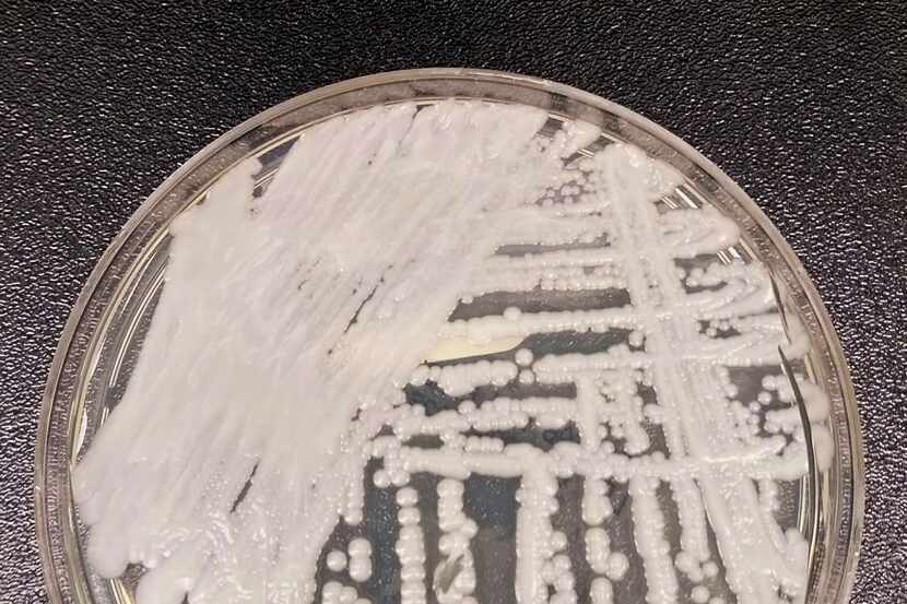 The fungal species Candida auris spread at an “alarming rate” from 2020 to 2021, according...