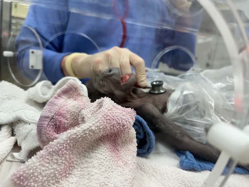 A baby gorilla named Jameela was born at the Fort Worth Zoo on Jan. 5, 2024, via a rare...