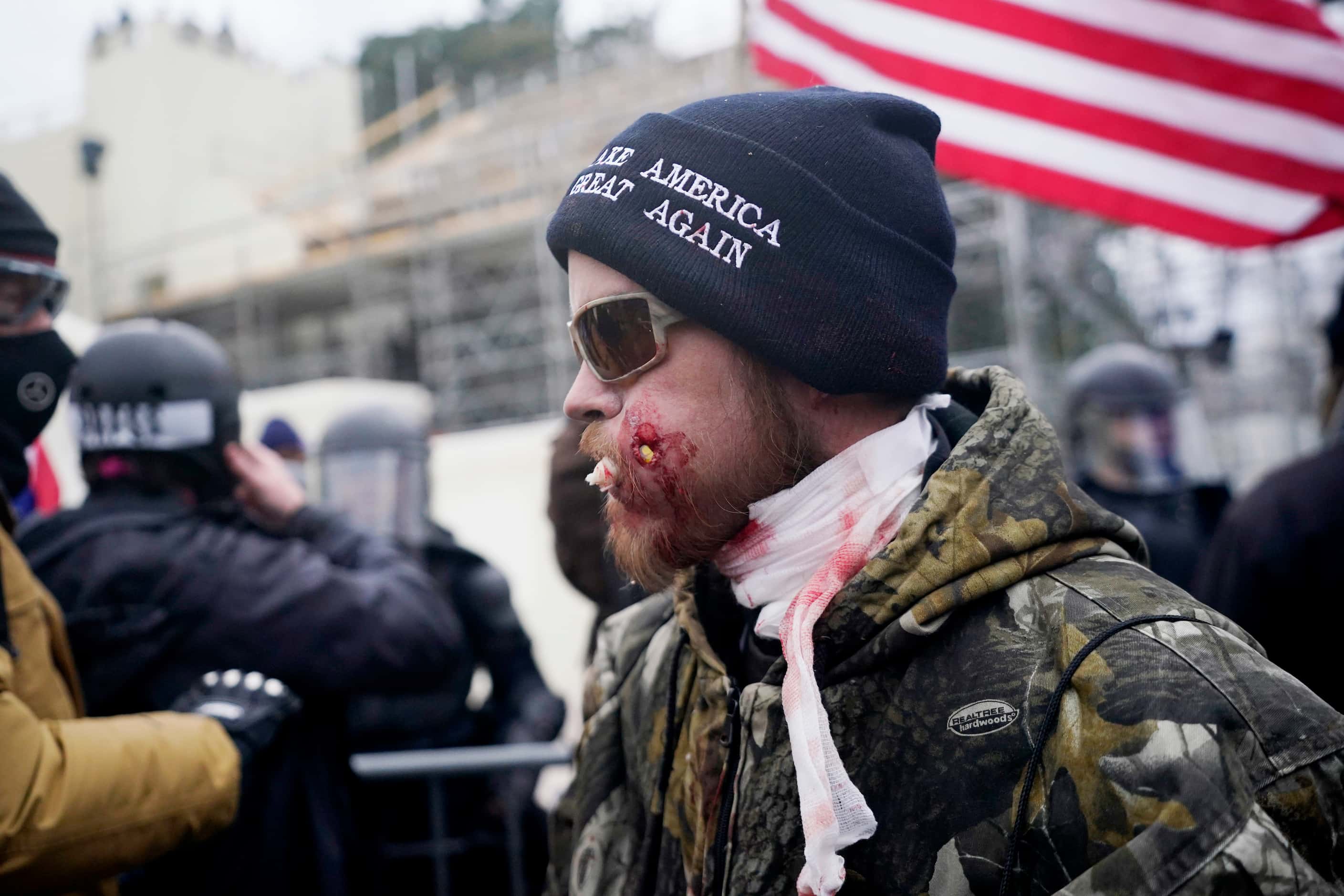 A protester is shown injured during a confrontation with police during a rally Wednesday,...