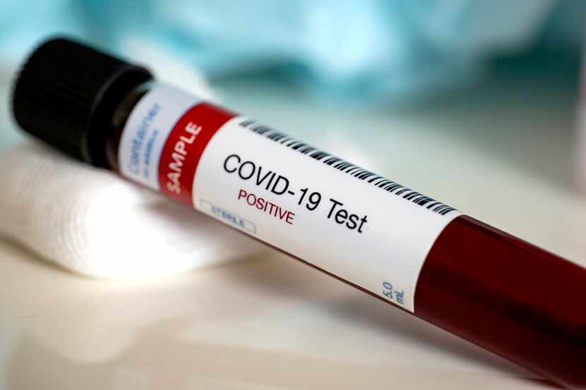 Dos personas del Norte de Texas fueron acusados de usar laboratorios y pruebas de covid-19...