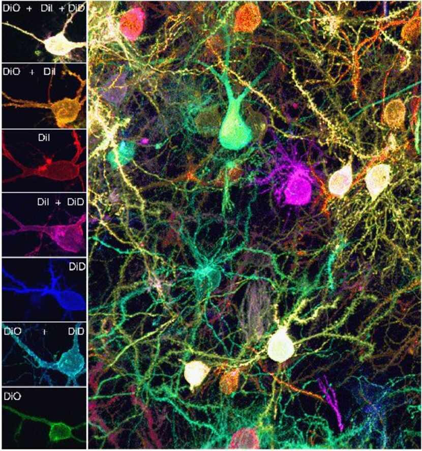 A cell-labeling technique invented by researchers at Washington University distinguishes...